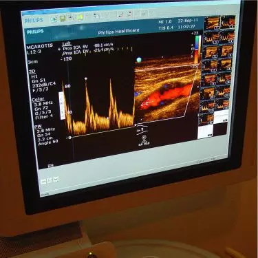 Best Colour Doppler Centre in Gurgaon India