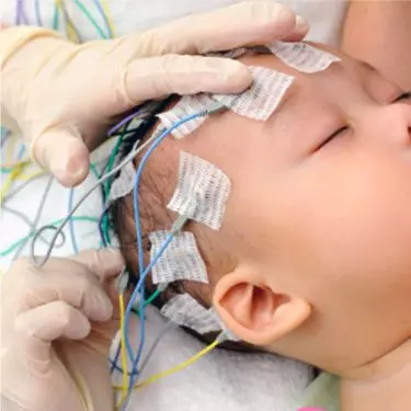 EEG Test in Gurgaon India