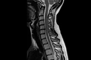 Best MRI Centre in Gurgaon, 1.5 Tesla MRI in Gurgaon, 3 Tesla MRI in Gurgaon, Lowest cost of MRI in Gurgaon, Breast MRI in Gurgaon, MR Angiography Test in Gurgaon, MR Spectroscopy in Gurgaon, MRI Brain in Gurgaon, MRI Knee Joint in Gurgaon, MRI Spine in Gurgaon, MRI Neck Vessels in Gurgaon, best diagnostic centre in Gurgaon, MRI Abdomen in Gurgaon, MRI Chest in Gurgaon, Contrast MRI in Gurgaon