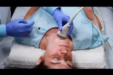 best diagnostic centre in gurgaon, usg guided fnac cost in gurgaon, fine needle aspiration cytology test, ultrasound for breast cancer