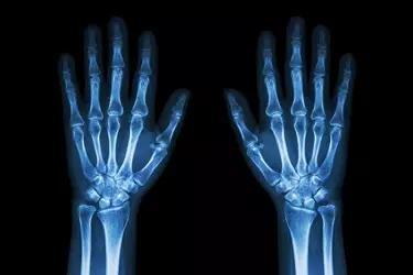 Digital Xray In Gurgaon, Digital Xray In bhiwadi